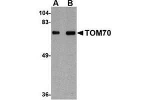 Western blot analysis of TOM70 in rat brain tissue lysate with this product at (A) 1 and (B) 2 μg/ml. (TOM70 antibody  (Center))