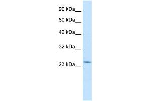 WB Suggested Anti-RGS13 Antibody Titration:  0. (RGS13 antibody  (Middle Region))