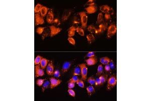 Immunofluorescence analysis of HeLa cells using IGFBP5 antibody (ABIN6130485, ABIN6142257, ABIN6142259 and ABIN6216084) at dilution of 1:100. (IGFBP5 antibody  (AA 68-167))