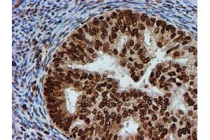 Image no. 1 for anti-Fragile X Mental Retardation 1 (FMR1) antibody (ABIN1498287) (FMR1 antibody)