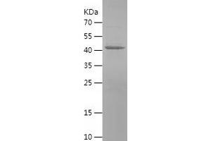 Western Blotting (WB) image for Monoamine Oxidase A (MAOA) (AA 129-319) protein (His-IF2DI Tag) (ABIN7124016) (Monoamine Oxidase A Protein (MAOA) (AA 129-319) (His-IF2DI Tag))