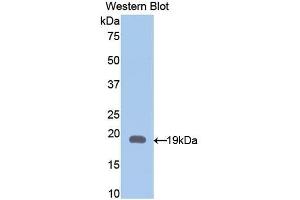 Detection of Recombinant GFAP, Rat using Polyclonal Antibody to Glial Fibrillary Acidic Protein (GFAP) (GFAP antibody  (AA 1-430))