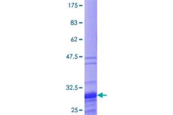 TNP1 Protein (AA 1-55) (GST tag)