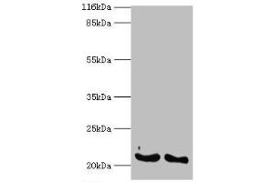 Western blot analysis of (1) A549 whole cell lysates and (2) mouse lung tissue, using IFNA14 antibody (2 μg/ml) and goat anti-rabbit polyclonal secondary antibody (1/10000 dilution).