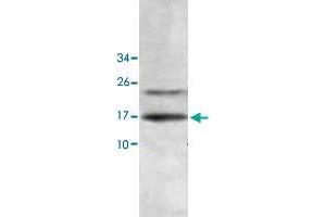 Western blot analysis of human fetal liver lysate with HINT2 polyclonal antibody  at 1 : 500 dilution. (HINT2 antibody  (AA 59-163))