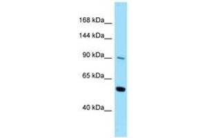Image no. 1 for anti-Colony Stimulating Factor 2 Receptor, Beta (CSF2RB) (AA 578-627) antibody (ABIN6748119) (CD131 antibody  (AA 578-627))