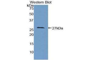 Western blot analysis of the recombinant protein. (GAS2 antibody  (AA 64-267))