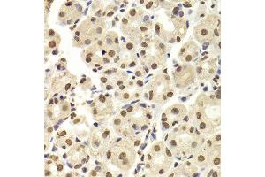 Immunohistochemistry (Paraffin-embedded Sections) (IHC (p)) image for anti-Heterogeneous Nuclear Ribonucleoprotein D (HNRNPD) (AA 1-306) antibody (ABIN6141905)