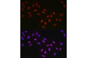 Immunofluorescence analysis of U2OS cells using CTBP2 Rabbit mAb (ABIN7265979) at dilution of 1:100 (40x lens). (CTBP2 antibody)
