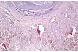 Anti-PLCG1 antibody IHC staining of human skin, Langerhans cell. (Phospholipase C gamma 1 antibody  (AA 751-800))