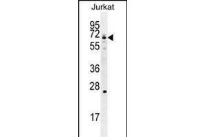 GCLC Antibody (N-term) (ABIN655884 and ABIN2845285) western blot analysis in Jurkat cell line lysates (35 μg/lane). (GCLC antibody  (N-Term))