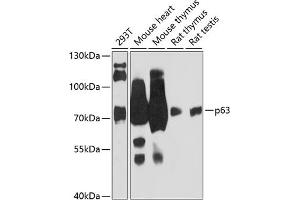 Western blot analysis of extracts of various cell lines, using p63 antibody (ABIN6133473, ABIN6149426, ABIN6149429 and ABIN6216798) at 1:3000 dilution. (p63 antibody  (AA 1-160))