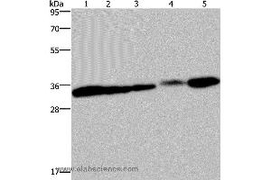 Western blot analysis of HUVEC and 293T cell, mouse bladder, human placenta and mouse kidney tissue, using CLDN23 Polyclonal Antibody at dilution of 1:200