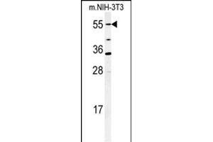 Western blot analysis of CYP26A1 Antibody (C-term) (ABIN650717 and ABIN2837925) in mouse NIH-3T3 cell lysates (35 μg/lane). (CYP26A1 antibody  (C-Term))