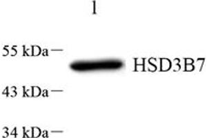 Western blot analysis of HSD3B7 (ABIN7074263) at dilution of 1: 1000,Lane 1: HeLa cell lysate (HSD3B7 antibody)