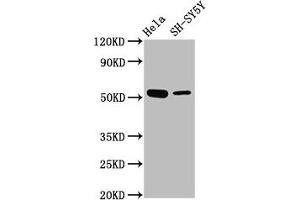 Western Blot Positive WB detected in: Hela whole cell lysate, SH-SY5Y whole cell lysate All lanes: MEX3A antibody at 4. (MEX3A antibody  (AA 416-466))