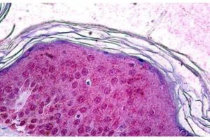Human Skin: Formalin-Fixed, Paraffin-Embedded (FFPE) (SOX10 antibody)