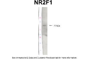WB Suggested Anti-N32F1 Antibody Titration: 2 ug/mlPositive Control: Protein extracts, Chicken brain tissue (NR2F1 antibody  (C-Term))