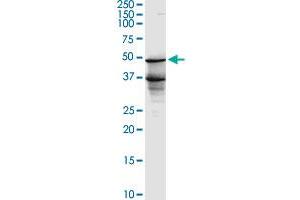 BLNK monoclonal antibody (M04), clone 1D7. (B-Cell Linker antibody  (AA 301-400))