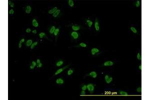 Image no. 3 for anti-Tripartite Motif Containing 24 (TRIM24) (AA 432-569) antibody (ABIN599067) (TRIM24 antibody  (AA 432-569))