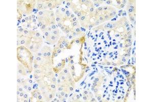 Immunohistochemistry of paraffin-embedded Mouse kidney using TDGF1 Polyclonal Antibody at dilution of 1:100 (40x lens). (TDGF1 antibody)