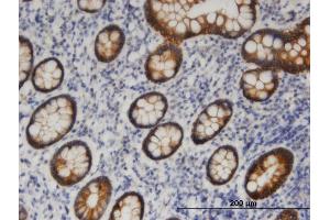 Immunoperoxidase of monoclonal antibody to PNPLA6 on formalin-fixed paraffin-embedded human small Intestine. (PNPLA6 antibody  (AA 1229-1327))