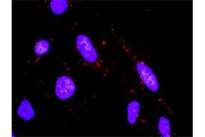 Proximity Ligation Analysis of protein-protein interactions between MAP2K3 and MAP2K6. (MAP2K6 antibody  (AA 231-334))