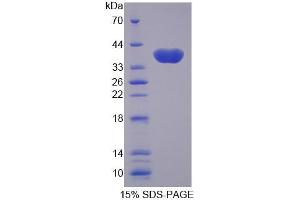 SDS-PAGE analysis of Human OGC Protein.