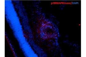 Immunohistochemistry analysis using Mouse Anti-p38 MAPK Monoclonal Antibody, Clone 9F12 (ABIN361679 and ABIN361680). (MAPK14 antibody)