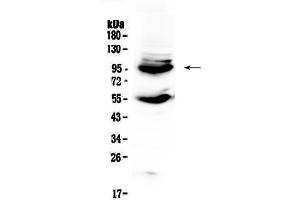 Western blot analysis of CD105 using anti-CD105 antibody .