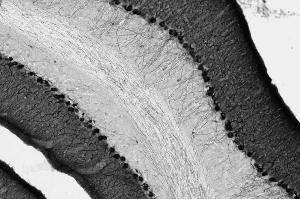 Adult rat brain hippocampus immunohistochemistry.