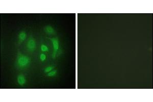 Immunofluorescence analysis of HepG2 cells, using hnRNP Q antibody. (SYNCRIP antibody)