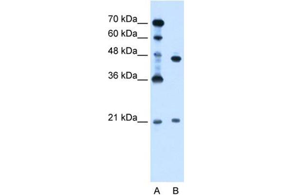 UBE2E2 antibody  (N-Term)