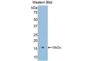 Detection of Recombinant CTGF, Human using Polyclonal Antibody to Connective Tissue Growth Factor (CTGF) (CTGF antibody  (AA 80-200))