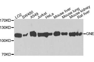 Western blot analysis of extracts of various cells, using GNE antibody. (GNE antibody)