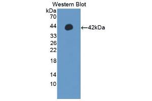 Western blot analysis of the recombinant protein. (IRF5 antibody  (AA 136-475))