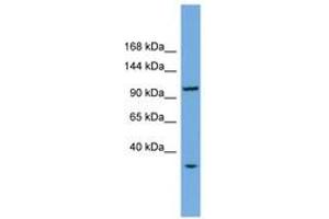 Image no. 1 for anti-CTF18, Chromosome Transmission Fidelity Factor 18 Homolog (CHTF18) (AA 755-804) antibody (ABIN6745169) (CTF18 antibody  (AA 755-804))