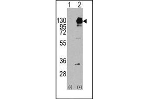Image no. 1 for anti-Platelet Derived Growth Factor Receptor alpha (PDGFRA) (Tyr754) antibody (ABIN359914)