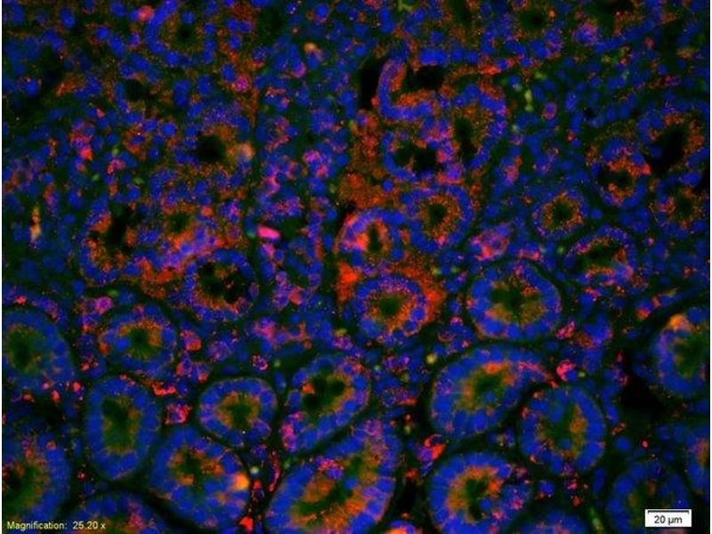anti cadherin-1 antibody IF image