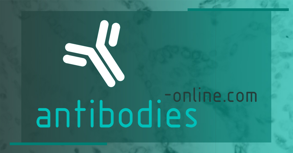 (c) Antibodies-online.com